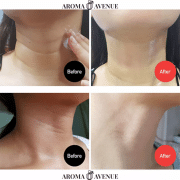 Obține un gât vizibil mai neted, ferm și tânăr cu MEDI-PEEL Neck Cream 2.0 – crema profesională care redefinește conturul pielii și combate semnele îmbătrânirii în profunzime.